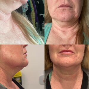 Skin Addiction - CSM - IMG1 - 5F9F498F-80D8-4922-B8C2-13A5D3BF61BA